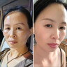 維特絲面膜美白補水保濕淡斑男女士去黃氣提亮膚色暗沉緊致抗皺熬夜修復 曬單實(shí)拍圖
