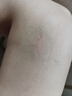 時(shí)珍世家金系列靜脈曲張專(zhuān)用蚯蚓腿可搭彈力襪進(jìn)口膏藥貼官方正品治療冷敷凝膠 曬單實(shí)拍圖