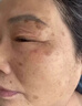 維a酸乳膏去老年斑專用的藥一夜臉部手背消強力祛斑專用霜去老人斑除黃褐雀斑黑色素男女士醫(yī)用官方正品藥膏 1盒藥膏【淡斑祛斑淡化黑色素】100%發(fā)貨特效快 曬單實拍圖