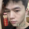初蔓氨基酸洗面奶男女士控油祛痘除螨蟲去黑頭深層清潔收縮毛孔潔面乳 【控油凈毛孔】B5潔面乳*1支 明星推薦B5洗面奶熱銷榜TOP 曬單實拍圖