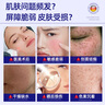 沃朗森醫(yī)用面膜型械字號(hào)醫(yī)美術(shù)后修復(fù)保濕補(bǔ)水消炎冷敷貼膠原蛋白 3盒 曬單實(shí)拍圖