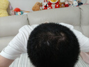 普門(mén)科技生發(fā)帽VSCEL紅藍光LLLT激光儀器健發(fā)帽智能頭盔養發(fā)護發(fā)教師禮物 【6級以下脫發(fā)】230顆+紅藍雙光 曬單實(shí)拍圖