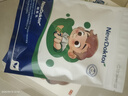 【德國品牌】 紐醫生 鼻炎貼兒童鼻貼鼻炎通鼻神器通氣鼻貼鼻竇炎砭貼過(guò)敏性鼻塞鼻癢 曬單實(shí)拍圖