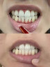 Mairulsy英國(guó)牙齦膏護(hù)齦固齒萎縮專(zhuān)用修復(fù)再I(mǎi)生十大知名品牌牙周I炎凝膠 3盒裝【牙齦I萎縮再生腫痛出血】 曬單實(shí)拍圖