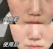 儒意（RUYI）377美白面膜補水男士保濕淡斑提亮膚色女抗皺緊致抗衰老去黃第1名 曬單實(shí)拍圖