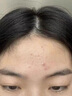 維特絲多酸泥膜油皮深度清潔泥膜祛黑頭粉刺閉口收縮毛孔涂抹面膜送女友 【控油吸黑頭】敏肌清潔泥膜130g 男女生禮物控油清黑頭收縮毛孔 曬單實(shí)拍圖