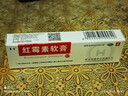 華青紅霉素軟膏藥膏潰瘍感染痤瘡痘痘潰瘍膿包消炎殺菌皮膚病 1盒裝 曬單實(shí)拍圖