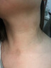 葆元醫生醫用皮膚敷料凝膠小肉粒疙瘩去除膏瘊子藥膏 3盒裝【性?xún)r(jià)比高 80%客戶(hù)選擇】大多情況都適用 曬單實(shí)拍圖