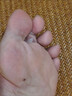 CNDK足部真菌王腳氣腳癢水泡脫皮腳臭香港腳腳汗爛腳丫真菌感染止癢膏 今日活動(dòng)【強效款-2盒療城裝】 曬單實(shí)拍圖