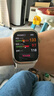 華為（HUAWEI）WATCH D2 晨曦金 華為智能手表動(dòng)態(tài)血壓監(jiān)測(cè)一鍵微體檢再升級(jí)多種健康研究輕巧時(shí)尚華為新款血壓表 曬單實(shí)拍圖