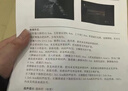【官方正品】香港森汐銀杏膠囊輔助降血脂 養肝護肝 清理內臟脂肪 1盒【建議周期使用效果更佳】 曬單實(shí)拍圖