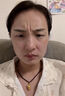 法令紋去除神器淡化去皺紋抬頭紋川字紋消除嘴角八字紋睡覺(jué)專(zhuān)用貼 買(mǎi)二送一【快速去除】 曬單實(shí)拍圖