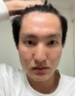 茉博士香港大藥房去痣點(diǎn)痣膏藥水臉部不留疤黑痣無(wú)痛修復液 曬單實(shí)拍圖