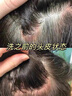 白云山二硫化硒洗發(fā)水380ml控油去屑持久蓬松止癢洗發(fā)膏露男女士金榜第1 曬單實拍圖