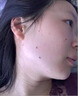 維A酸乳膏去疣體特新效期藥扁平疣專用藥去疣類藥膏去脖子小肉粒頸部瘊子去尤瘊小肉粒去疣膏瘊子肉刺肉粒 1盒裝【國藥準(zhǔn)字脫疣瘊】 瘊子去除國藥準(zhǔn)字藥膏  放心購買 安心售后 曬單實(shí)拍圖