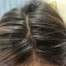 kuvive防脫育發(fā)洗發(fā)水500ml生姜洗發(fā)露男女士固發(fā)養發(fā)米諾地爾金榜第1名 曬單實(shí)拍圖