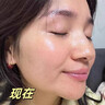 奈皙日本377煙酰胺美白祛斑霜淡化黑色素去雀斑老年黃褐斑面霜男女士 曬單實(shí)拍圖