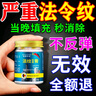 澳福來法令紋去除神器填充膠原蛋白淡化嘴角八字紋睡覺專用消除面膜貼膏 一盒裝 50g 【秒去除 變18歲】 曬單實(shí)拍圖