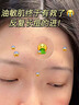 醫(yī)用精華液械字號收縮毛孔粗大修復(fù)細致去黑頭粉刺閉口男士女士祛痘印黑色素沉淀控油淡化痘印痘坑透明質(zhì)酸鈉 曬單實拍圖