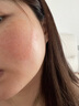 普門科技醫(yī)用大排燈美容儀紅藍(lán)黃光治療敏感肌痘痘痤瘡消炎七夕禮物送女友 光E【三光+12模式】 曬單實(shí)拍圖