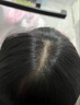 頭虱子兒童虱子藥小女孩去除在頭發(fā)頭上長(zhǎng)的虱卵虱子虱立凈百部酊 1瓶裝+篦子浴帽 曬單實(shí)拍圖