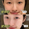 奈皙日本曬后修復面膜急救敏感泛紅女男士夏季神經(jīng)酰胺改善醫美用煥白 曬單實(shí)拍圖