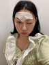 Redact澳洲抬頭紋川字紋貼去除神器額頭皺紋貼去除男女抗皺緊致衰老專(zhuān)用 曬單實(shí)拍圖
