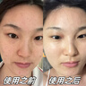 時(shí)珍世家金系列煙酰胺醫(yī)用凝膠原液100%國(guó)家藥監(jiān)批準(zhǔn)保健字正品臉部男女士美白 曬單實(shí)拍圖