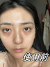 奈皙日本眼膜眼袋提拉緊致抗皺淡化細(xì)紋黑眼圈去除神器男士嚴(yán)重專用女 曬單實(shí)拍圖