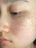 SEEDONVEUR美白祛斑霜淡化黑色素去斑霜雀斑黃褐斑老年斑曬斑煙酰胺凝膠 20g 曬單實(shí)拍圖