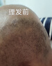 奧克斯（AUX）光頭神器剃光頭專(zhuān)用自理發(fā)器成人電動(dòng)家用自助大功率刮頭剃須刀 剃光頭/胡須送爸爸 曬單實(shí)拍圖