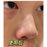 儒意去角質(zhì)面部啫喱控油保濕洗面奶男女士臉部清潔毛孔黑頭閉口敏感肌 【一次見效】去角質(zhì)啫喱 300g 曬單實(shí)拍圖