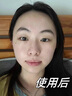 Losoki瑞士進(jìn)口377面膜美白補(bǔ)水淡斑提亮膚色女男士抗皺緊致抗衰老熬夜 曬單實(shí)拍圖