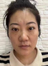 絲幕川字紋去除神器抬頭紋男重度去皺紋去法令紋貼睡覺(jué)貼女去額頭皺紋 1盒醫用膏【消紋緊致 當天見(jiàn)效】 專(zhuān)用填充去皺紋抗衰老眉間貼進(jìn)口 曬單實(shí)拍圖