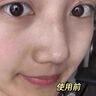 儒意（RUYI）去黑頭鼻貼免撕拉面膜黑頭導出液清理神器收縮毛孔清潔粉刺男女士 曬單實拍圖