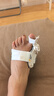 FITJOY醫用腳趾矯正器拇外翻分趾器大拇指糾正大腳趾頭腳骨突出成人兒童 【單只裝】不分左右腳+贈日用硅膠+日夜套裝 M（33-38鞋碼可穿) 曬單實(shí)拍圖