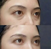 Losoki瑞士進(jìn)口眼霜淡化細紋提拉緊致黑眼圈去眼袋抗皺抗衰老護膚品禮物 曬單實(shí)拍圖