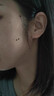 GEKX祛痣點(diǎn)痣膏無(wú)痕臉部黑痣痦子扁平疣瘊子祛斑點(diǎn)斑專(zhuān)用非薬水面部 曬單實(shí)拍圖