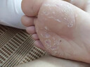 CNDK足部真菌王腳氣腳癢水泡脫皮腳臭香港腳腳汗?fàn)€腳丫真菌感染止癢膏 濃度999+【強效款嚴(yán)重腳氣】 曬單實拍圖