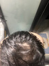 【第二代米諾地爾】蔓迪5%生發(fā)泡沫劑60g（倍速生發(fā) 溫和不起痘）男女士專(zhuān)用治脫發(fā)防脫育發(fā)米洛原液酊搽劑 曬單實(shí)拍圖