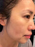 哈吉森博士377面霜美白祛斑霜有特證抗皺衰老保濕提亮膚色乳液護膚男士女士 曬單實(shí)拍圖