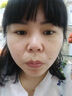 滬徑制藥去痣點(diǎn)痣膏祛痣點(diǎn)痣點(diǎn)疣藥水點(diǎn)痣醫用專(zhuān)用官方正品黑痣臉部不留疤 曬單實(shí)拍圖