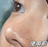 韓方五谷去黑頭鼻貼清潔泥膜祛粉刺深層清潔毛孔鼻膜神器撕拉面膜男女士 曬單實(shí)拍圖
