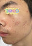SKISGEM德國進(jìn)口除螨蟲(chóng)祛痘氨基酸洗面奶控油男女士去黑頭縮毛孔潔面乳 100g【輕度痘痘可用 除螨控油】 曬單實(shí)拍圖