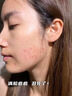 鵲優(yōu)堂參氏珍芙 荷太凈芙 參芪珍芙煥顏膏滲氏換膚霜珍夫申芪奇珍扶煥顏 買2送1【90%用戶選擇】 曬單實(shí)拍圖