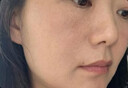 EDRI法令紋去消除神器睡覺專用提拉緊致抗皺去法令紋嘴角皺紋八字紋貼 曬單實拍圖