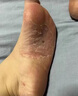 達(dá)克寧腳氣藥止癢脫皮爛腳丫真菌感染治腳氣達(dá)克寧硝酸咪康唑乳膏腳臭腳氣藥止癢真菌感染皮膚用藥 非處方藥 2盒【硝酸咪康唑乳膏】癢的受不了 老是摳腳 達(dá)克寧腳氣藥止癢脫皮爛腳丫真菌感染治腳氣 曬單實(shí)拍圖
