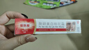 SEEDONVEUR美白祛斑霜淡化黑色素去斑霜雀斑黃褐斑老年斑曬斑煙酰胺凝膠 20g 曬單實(shí)拍圖
