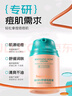 BEAUTY NOTES青少年祛痘膏男女學(xué)生護(hù)膚品12-18歲青春痘淡化祛痘印粉刺痘坑50g 曬單實(shí)拍圖