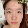 透真377美白精華液次拋淡化黑色素祛斑去黃提亮改善暗沉膚色煙酰胺女 曬單實(shí)拍圖